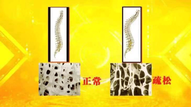 为什么老年人习惯背手走路？