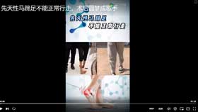 先天性马蹄足不能正常行走，术后圆梦成歌手