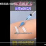 3D动画演示无痛胃肠镜