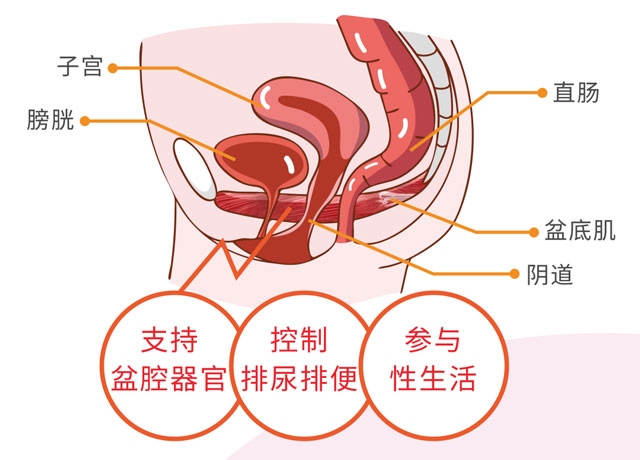 女性漏尿，赶紧查查盆底功能是否出了问题！