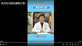 先天性马蹄足康复之路