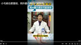 小毛病也要重视，拇外翻小病也可能致残。