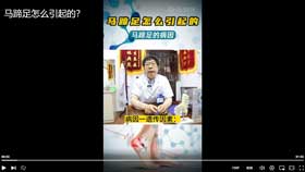马蹄足怎么引起的？