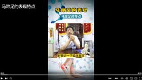 马蹄足的表现特点