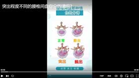 突出程度不同的腰椎间盘你分的清吗？