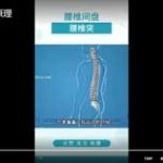 腰椎间盘突出原理