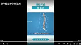 腰椎间盘突出原理
