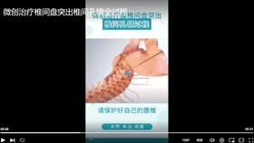 微创治疗椎间盘突出椎间孔镜全过程