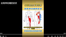 坐骨神经痛的症状