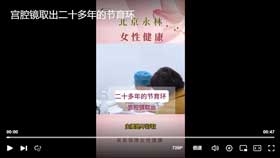 宫腔镜取出二十多年的节育环