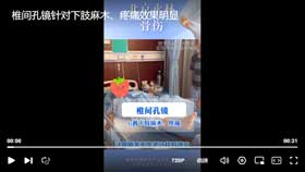 椎间孔镜针对下肢麻木、疼痛效果明显