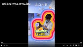 颈椎曲度异常手法复位