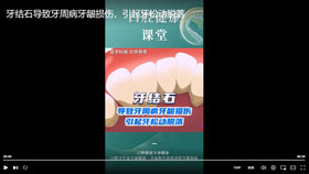 牙结石导致牙周病牙龈损伤，引起牙松动脱落