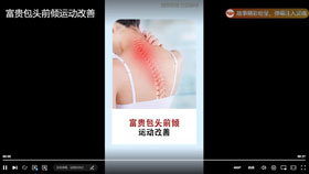 富贵包头前倾运动改善