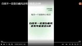 白斑不一定是白癜风还有可能是这6种